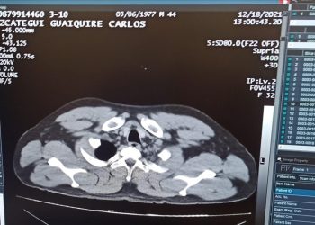 Yolcunun midesinden 12 kapsül kokain çıkarıldı